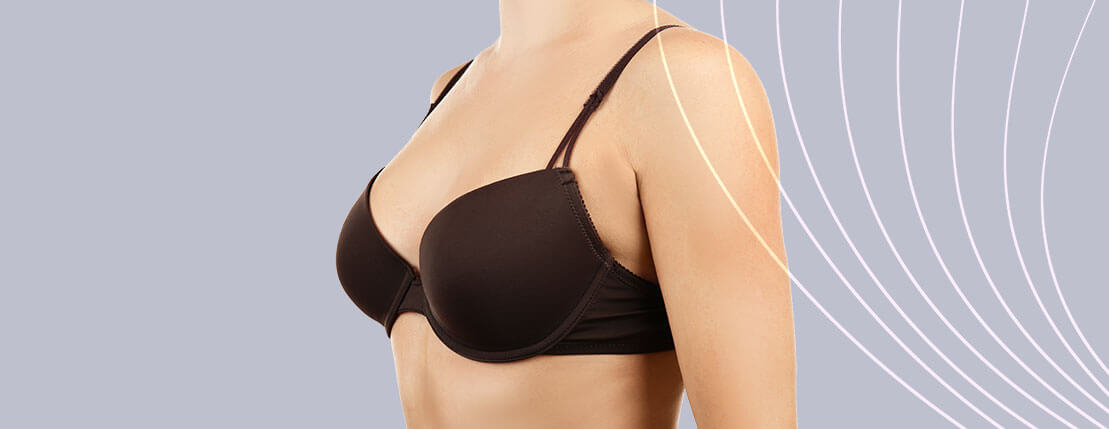 Imagem Mastopexia